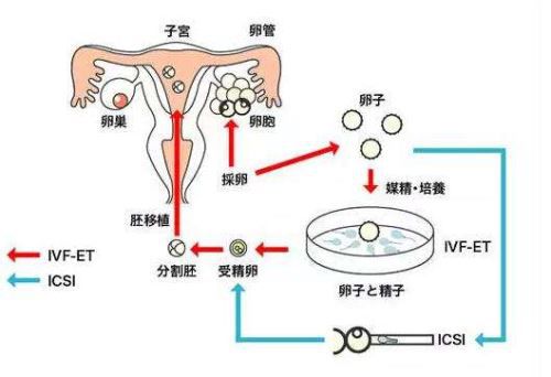 上海试管助孕