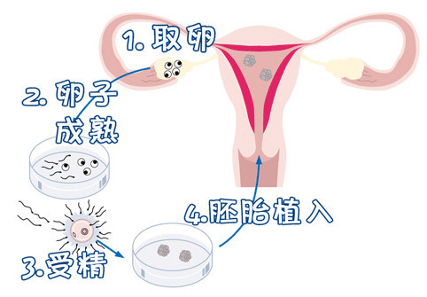 上海世纪助孕骗局