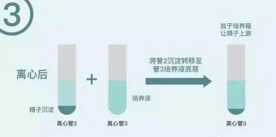 代孕