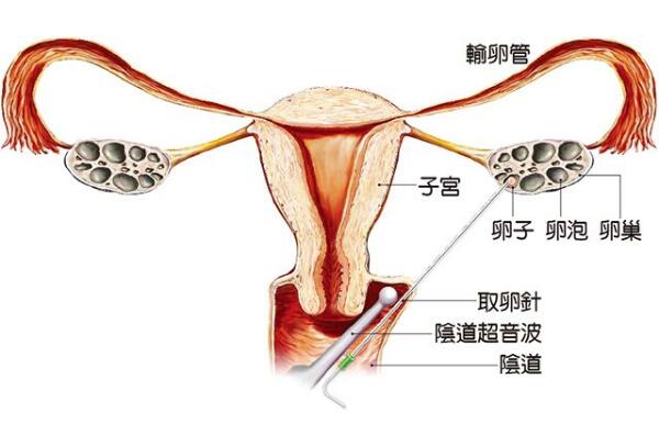 上海 代孕