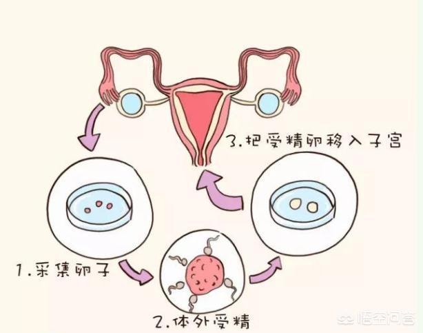 高薪招聘代妈